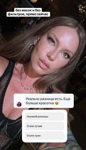 «Да здравствуют современные технологии»: как выглядит Рита Дакота после пластической операции