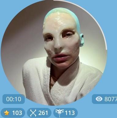 «Все пишут, что я в рехабе»: Глюкоза вышла на связь с поклонниками без волос и со странным лицом