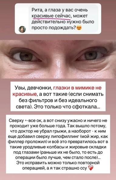 Жертва маркетинга: почему Рите Дакоте пришлось повторно лечь под нож хирурга