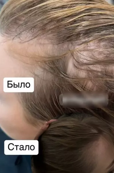 «Кошмар»: молодая жена Диброва почти облысела после двухлетнего наращивания волос