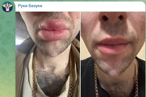 Фото до и после