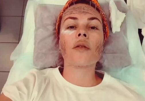 Целый список процедур: что со своим лицом делала ведущая Екатерина Андреева