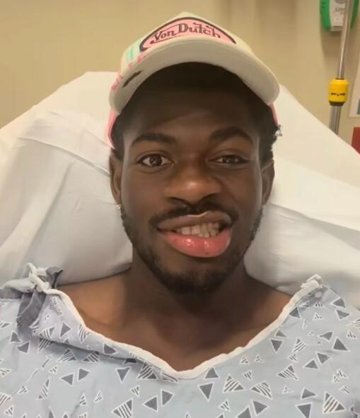 У 26-летнего рэпера Lil Nas X парализовало половину лица