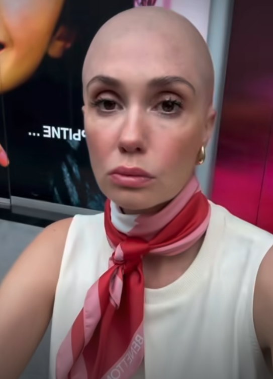 «Мне сожгли волосы»: беременная Агата Муцениеце неожиданно облысела