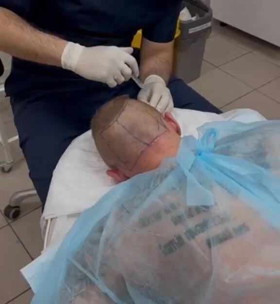 «Прошла успешно»: футболист Дмитрий Тарасов перенес операцию на голове