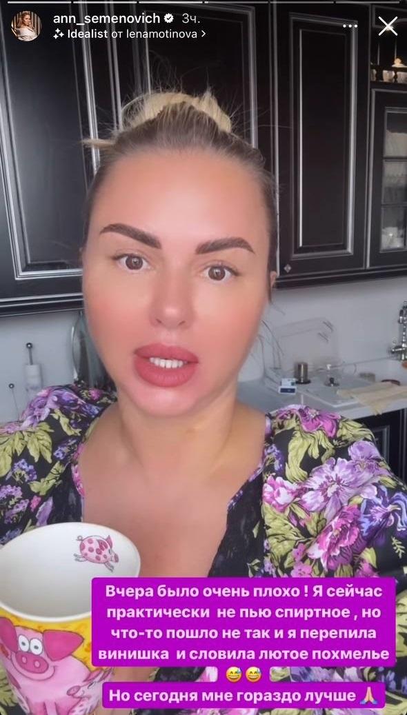 «Кто-то перегулял»: Анна Семенович показала лицо и призналась, что страдает от похмелья
