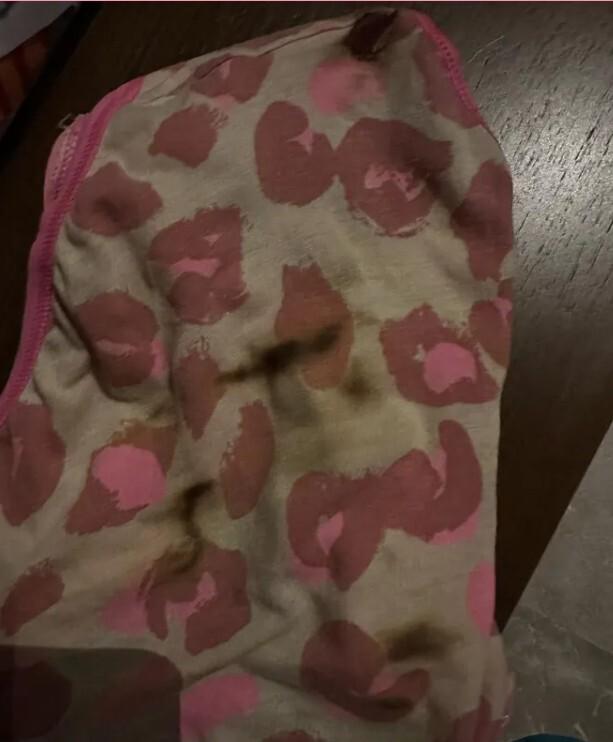 Лера Кудрявцева показала испорченные трусы