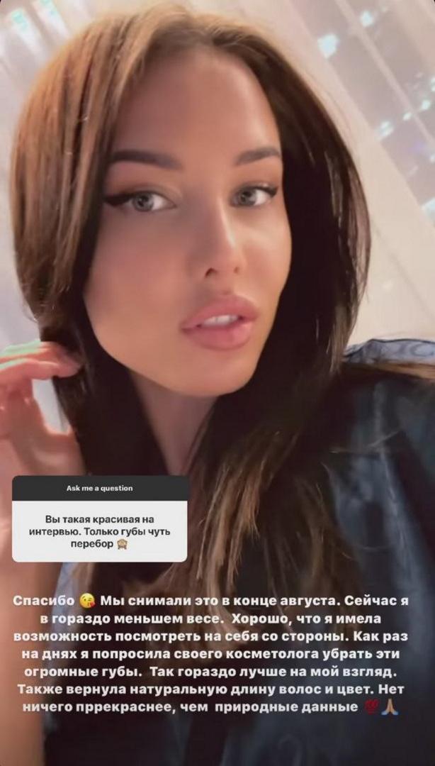 Анастасия Решетова выступила против уколов красоты