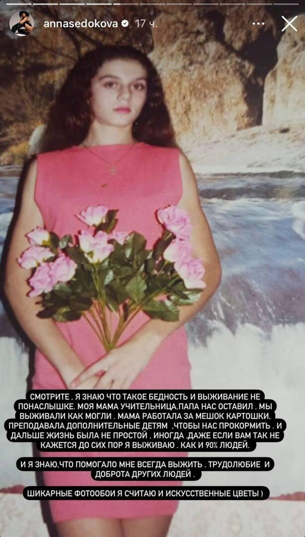 «Я знаю, что такое бедность»: Анна Седокова поделилась архивным фото из юности
