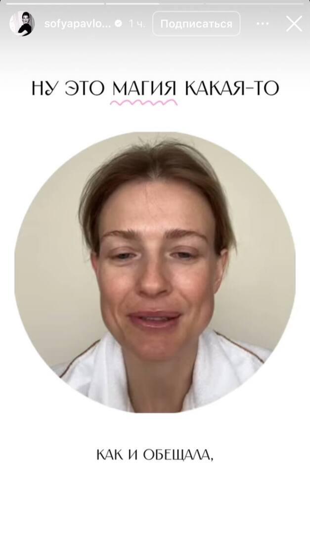 «Была другим человеком»: жена Эрнста показала, как изменилась за шесть дней лечения в санатории