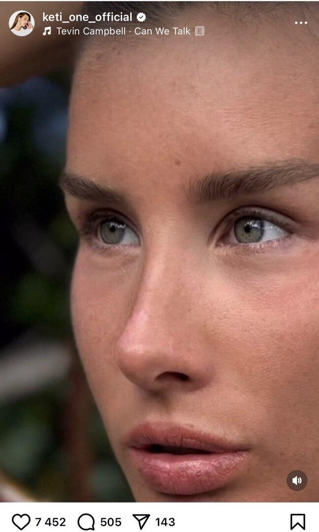 Солистку A'Studio Кети Топурию заподозрили в пластике лица: как выглядит певица