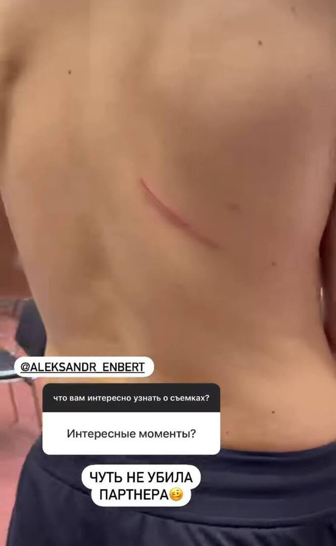 Сторис Регины Тодоренко