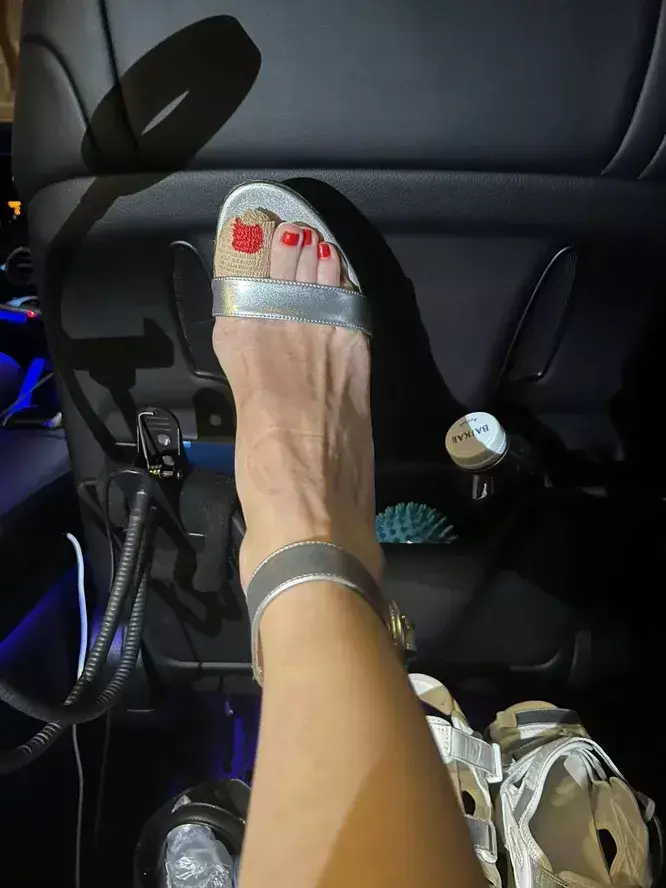 «Были необходимы»: Глюкозе сделали несколько операций