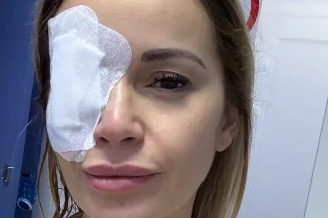 «Для храбрости дали настойку»: Ольга Орлова показала фото после операции по замене хрусталиков