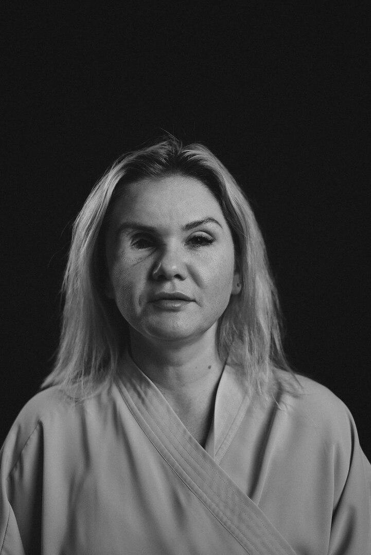 «Я получила великий дар — жизнь»: история россиянки, которая «прозрела», лишившись глаза после избиения бывшим