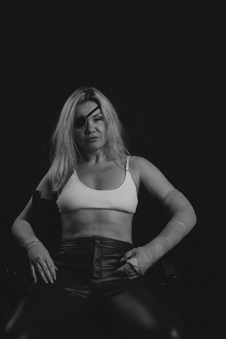 «Я получила великий дар — жизнь»: история россиянки, которая «прозрела», лишившись глаза после избиения бывшим