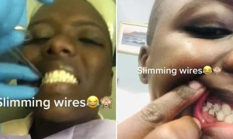 «Зашила» рот: девушка из ЮАР нашла экстремальный способ похудения