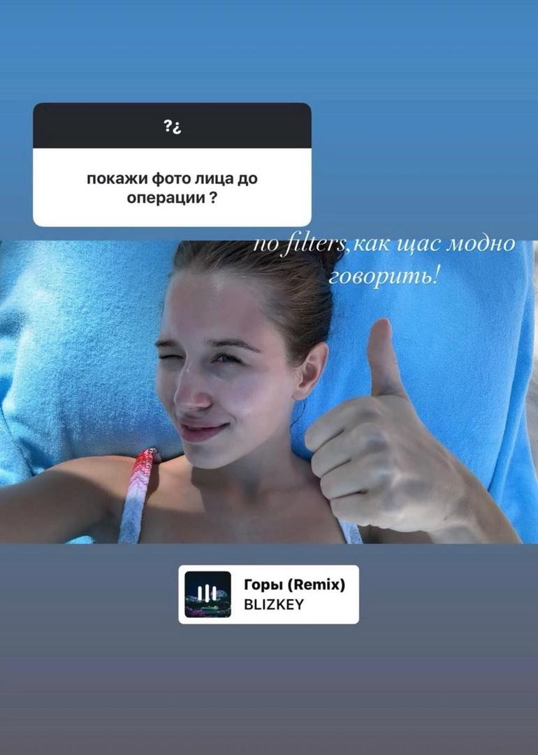 19-летняя невеста Григория Лепса показала, как выглядела до ринопластики