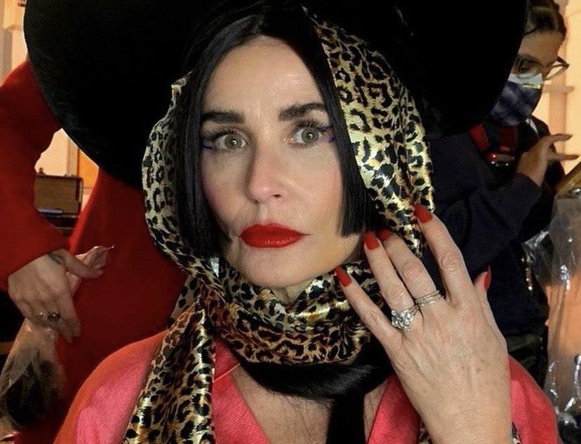 Топ-4 мировых звезд, которых изуродовала пластическая хирургия