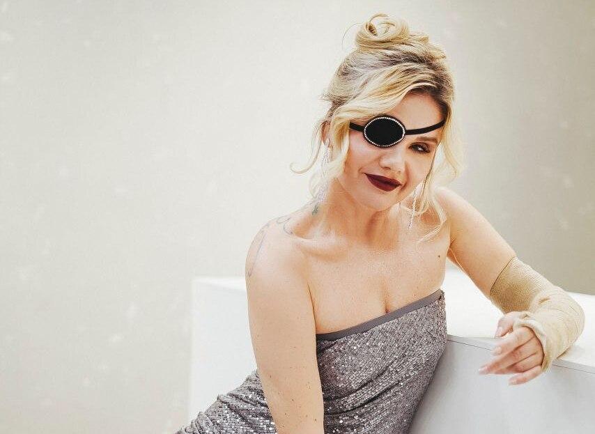 Лишившаяся глаза после избиения бывшим россиянка рассказала о предстоящих операциях и пластике