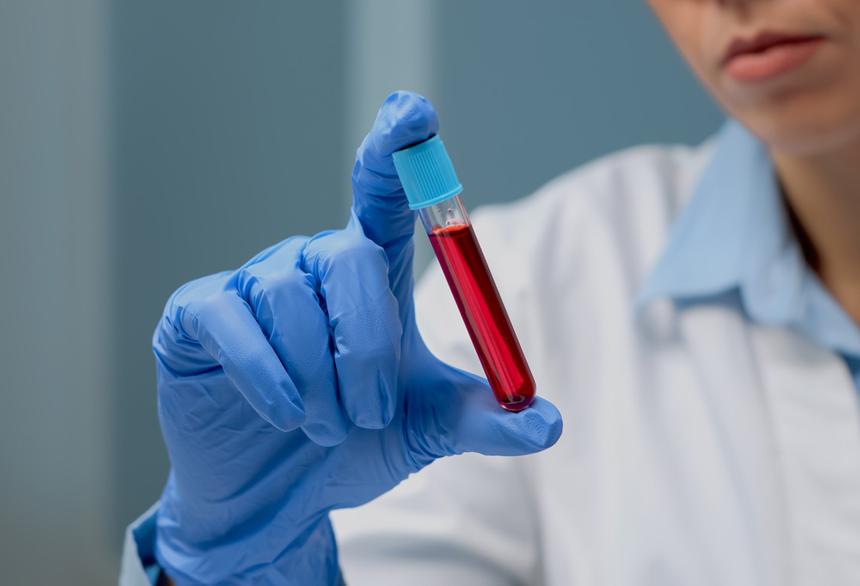 Iron man: почему возникает дефицит железа и как от него избавиться