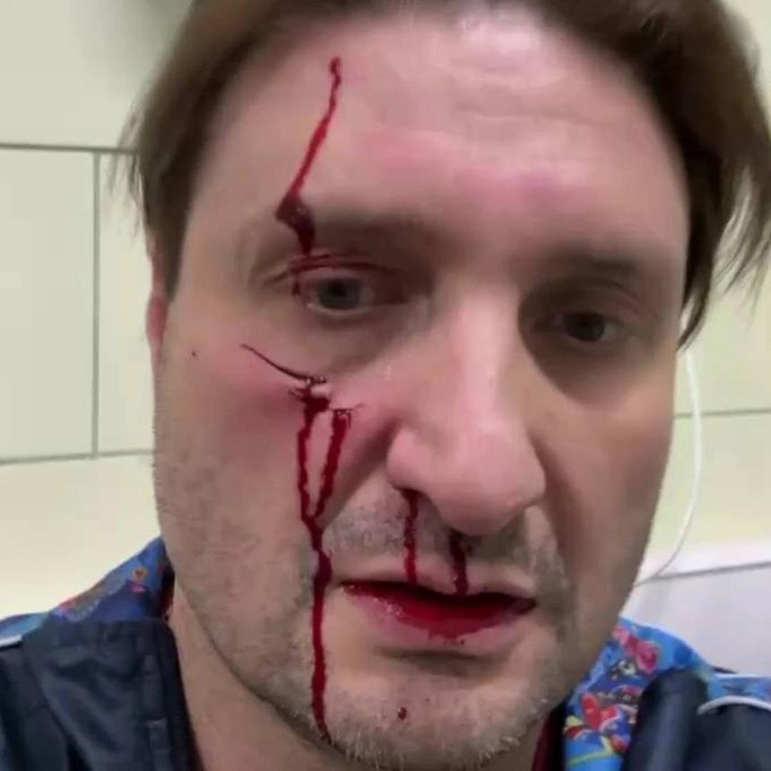 ШОК: На Эдгара Запашного напал тигр