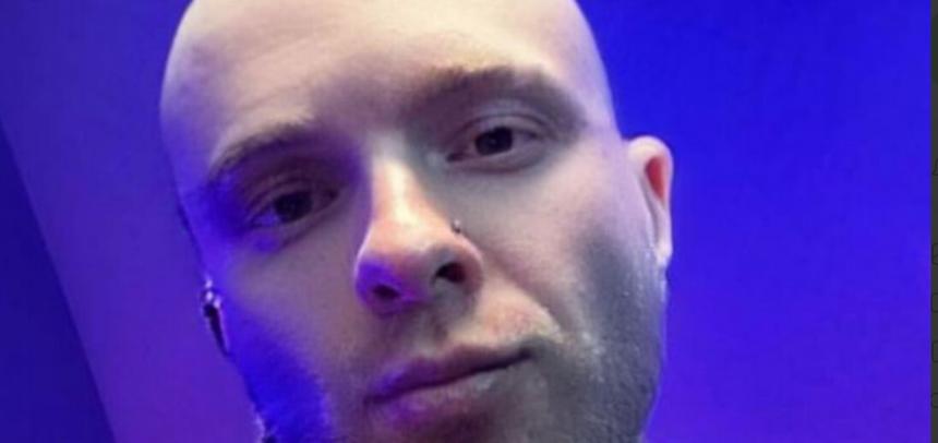 ШОК: Егор Крид внезапно облысел