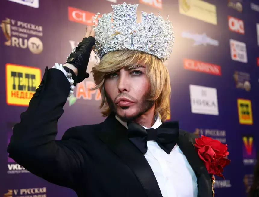 «Мыться нельзя»: Сергей Зверев показал, что случилось с его телом