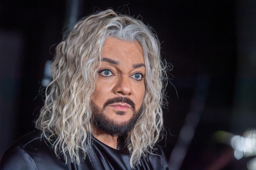 «День критический»: перешитый хирургом Киркоров изнывает от боли