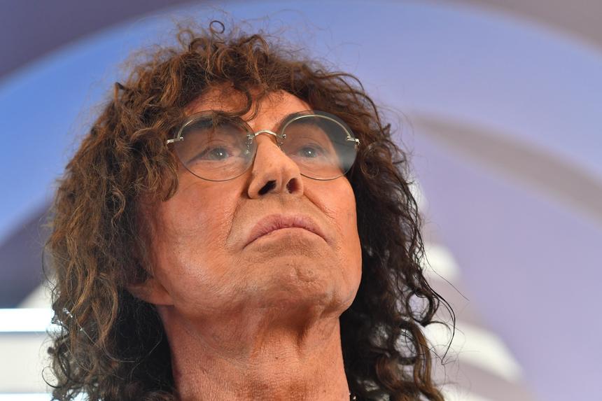 У Валерия Леонтьева после двух подтяжек лица деформировались уши