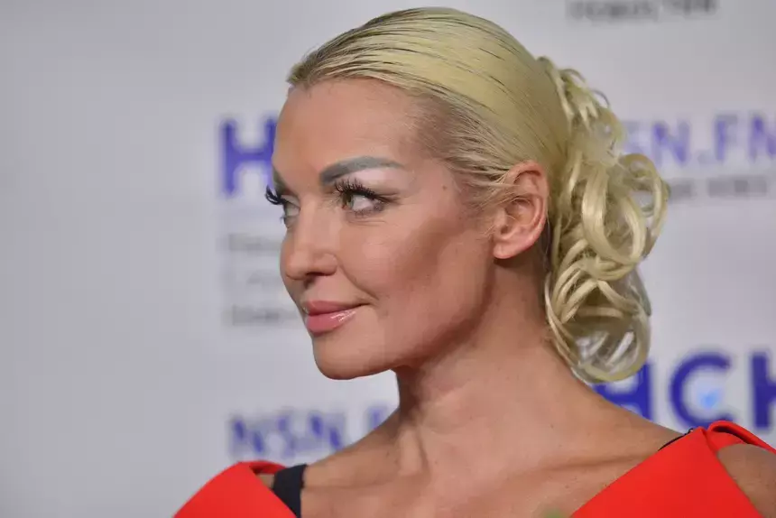 «Не могу позволить»: Волочкова объяснила, почему носит накладные волосы