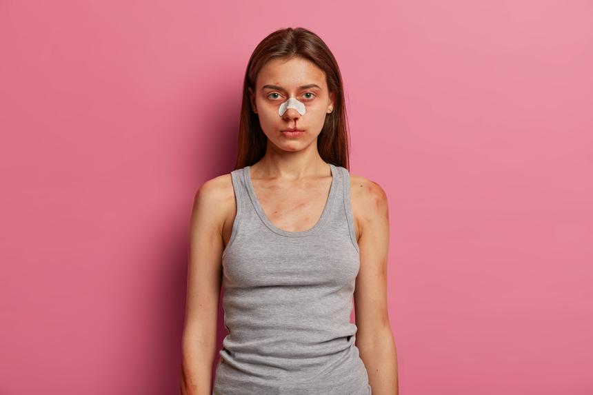 Житель Азова сломал челюсть своей несовершеннолетней возлюбленной