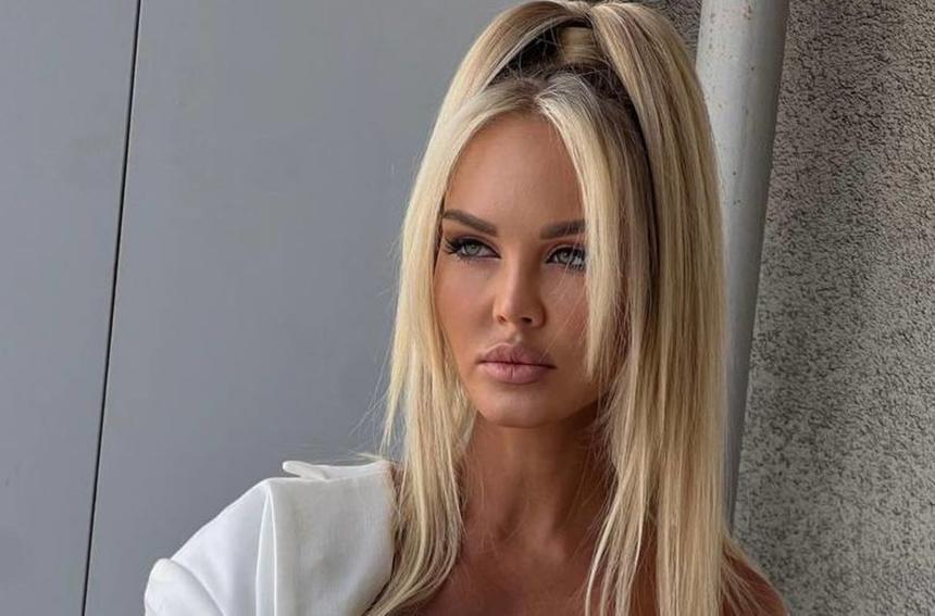 «Губы не спасем»: Марии Погребняк разрезали пол-лица из-за неудачной косметологической процедуры