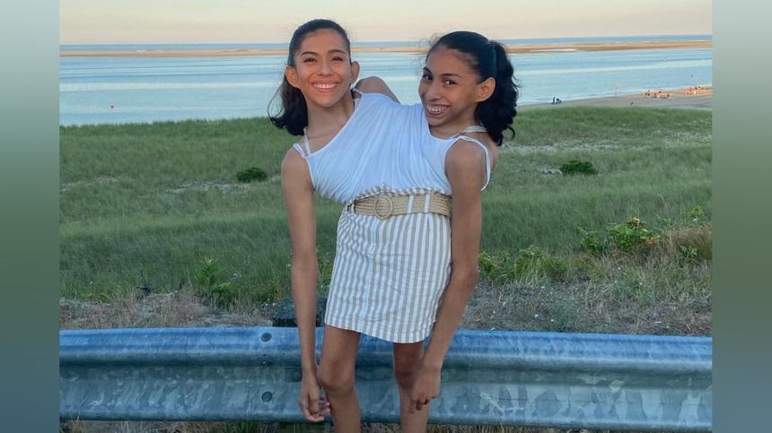 У сиамских близнецов из США общий половой орган, но только у одной есть парень