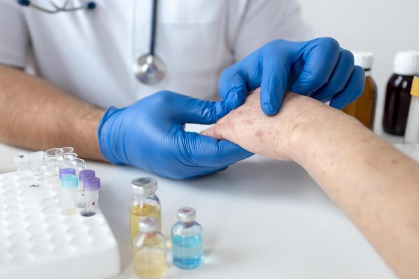 Почему в России вспыхнула корь: эксперты назвали две причины