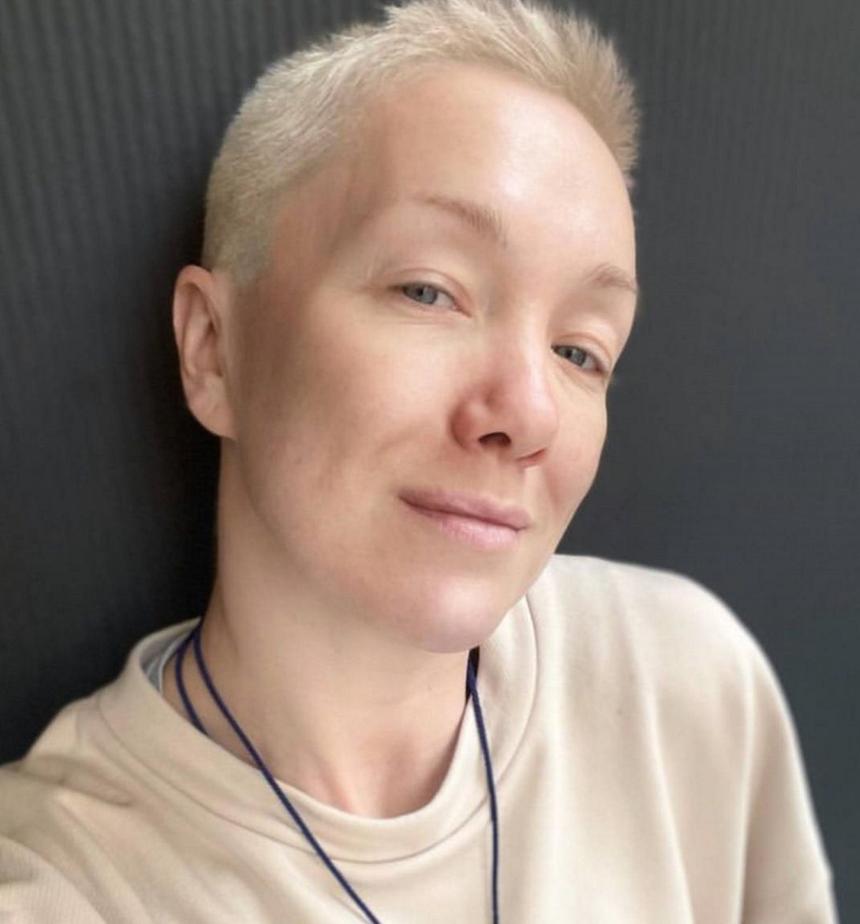 «На ней лица нет»: 39-летняя актриса Дарья Мороз напугала поклонников болезненным видом