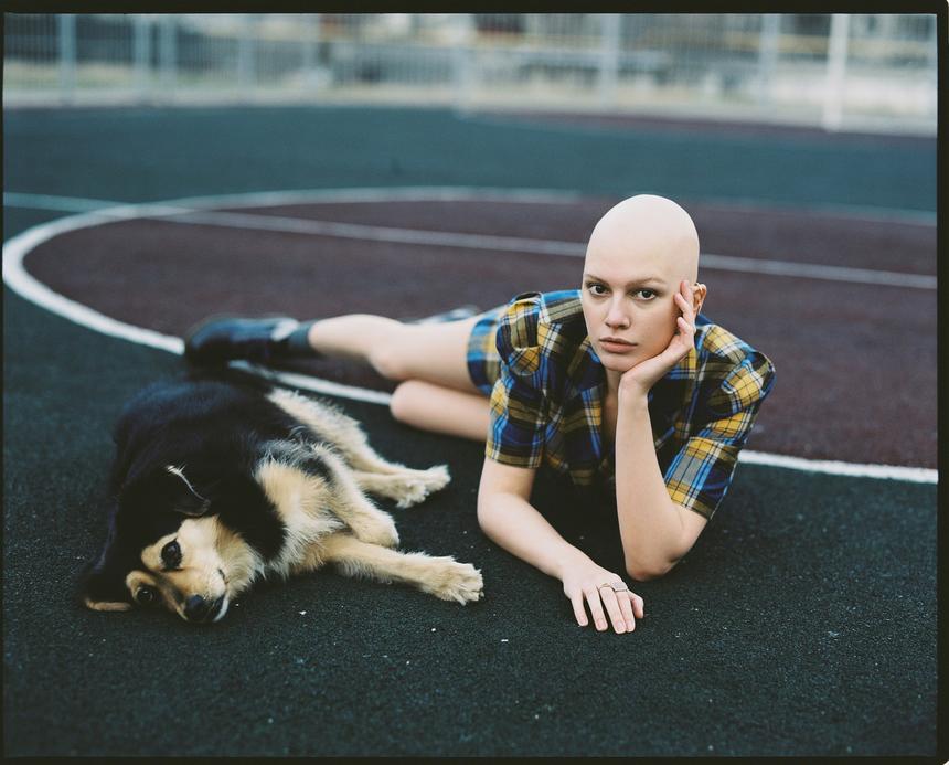 «Она же лысая»: актриса с алопецией рассказала о карьере в кино и осуждении коллег