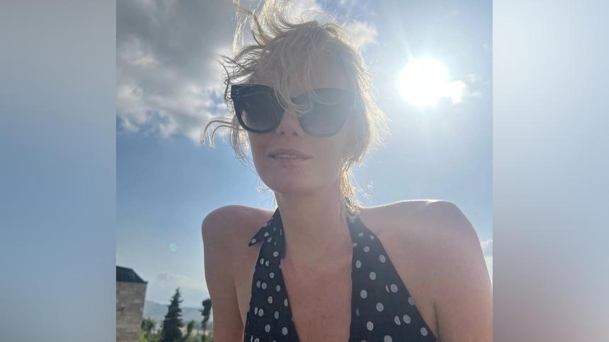 Не руки, а кости: у Ренаты Литвиновой подозревают серьезную болезнь