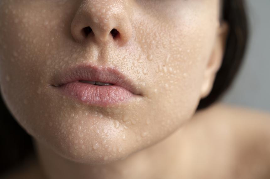 Что вы не знали о жирной коже лица: дерматолог Бедаева об особенностях ухода