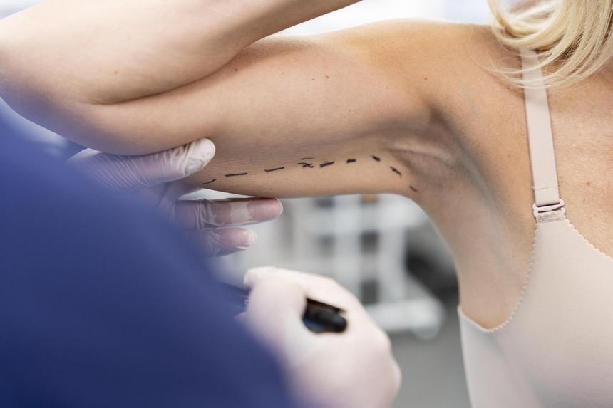 Что россияне хотят в себе изменить: топ-6 популярных пластических операций