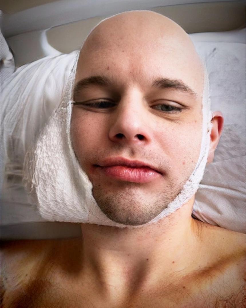 Tomilove после избиения