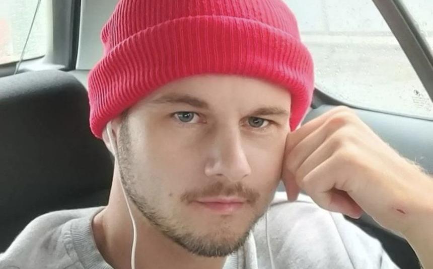 «Половиной лица не могу управлять»: избитый в Москве певец Tomilove раскрыл детали нападения