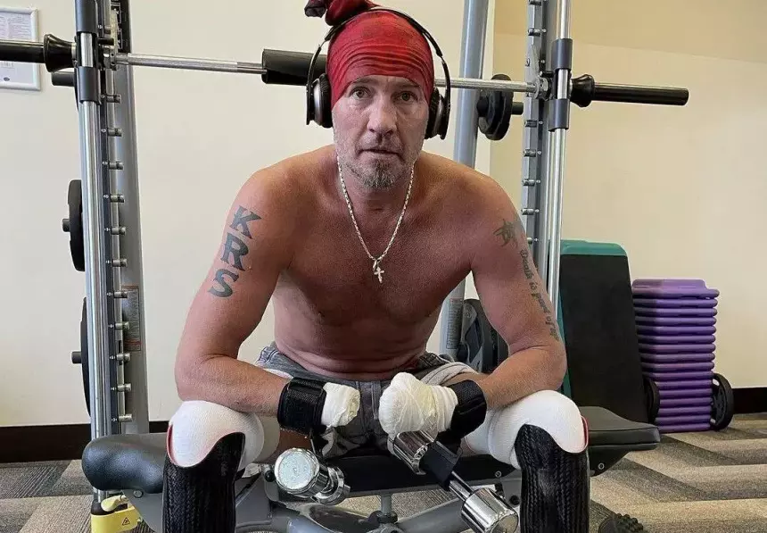 Перенесший ампутации Костомаров признался, что самоирония помогла ему показаться на людях