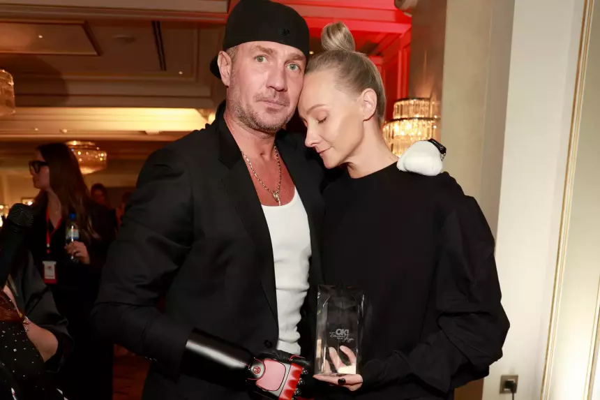 Оксана Домнина рассказала о жизни с Романом Костомаровым после ампутаций