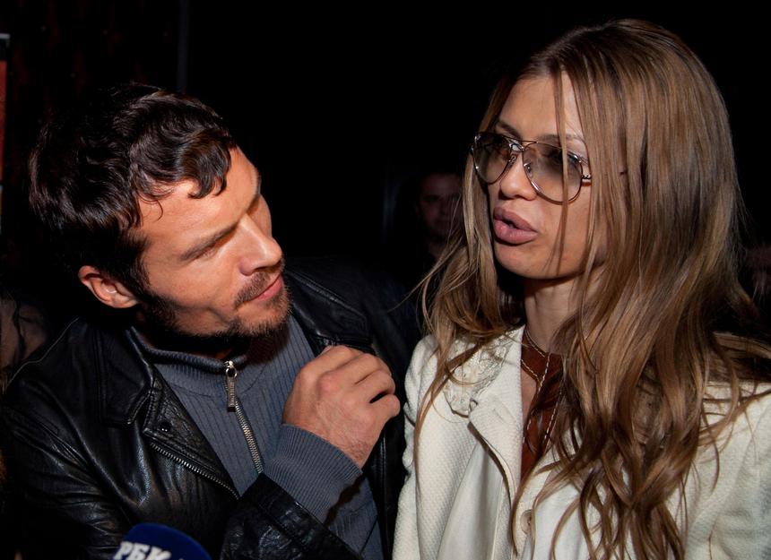 Ни филлеры, ни аппаратная косметология не поднимали лицо: пластический хирург рассказал о Виктории Боне до операции