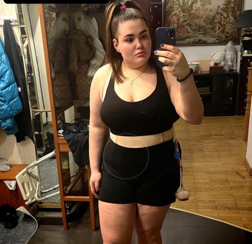 Даная Пригожина после операции