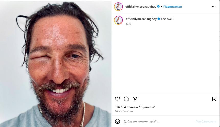 Мэттью Макконахи изменился до неузнаваемости после укусов пчел