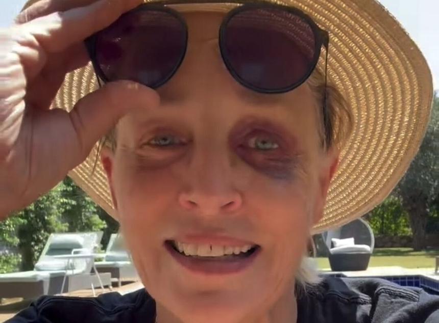 «Не знала, где нахожусь»: Шэрон Стоун рассказала, как заработала синяк под глазом