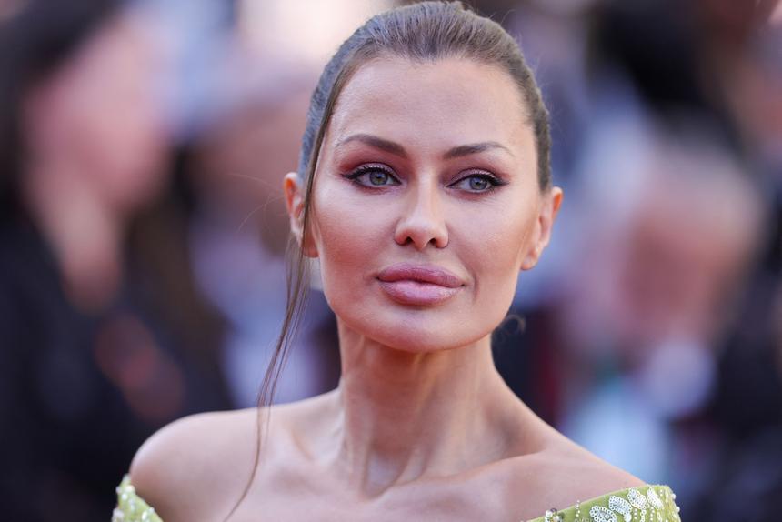 Виктория Боня заявила, что Алена Водонаева разбила ей лицо и оставила шрам