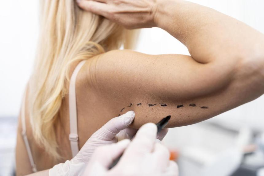 Рубцы, изменение формы тела: последствия пластической хирургии, о которых молчат врачи